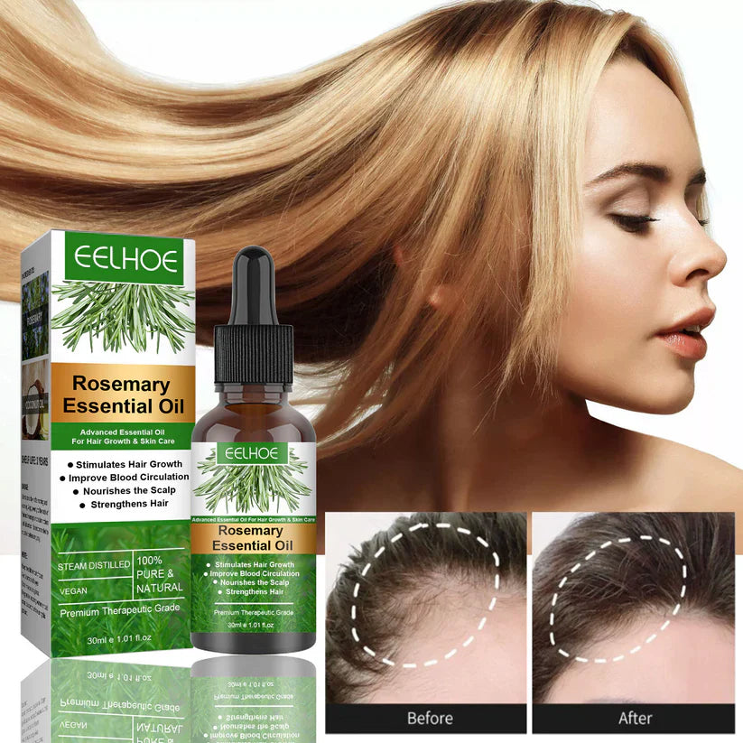 Rosemary Oil Blend -Hair Growth