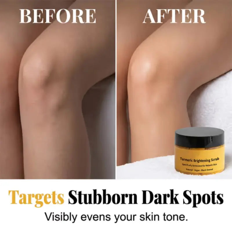 🔥BUY 2 GET 1 FREE🔥Turmeric Exfoliating Body Scrub