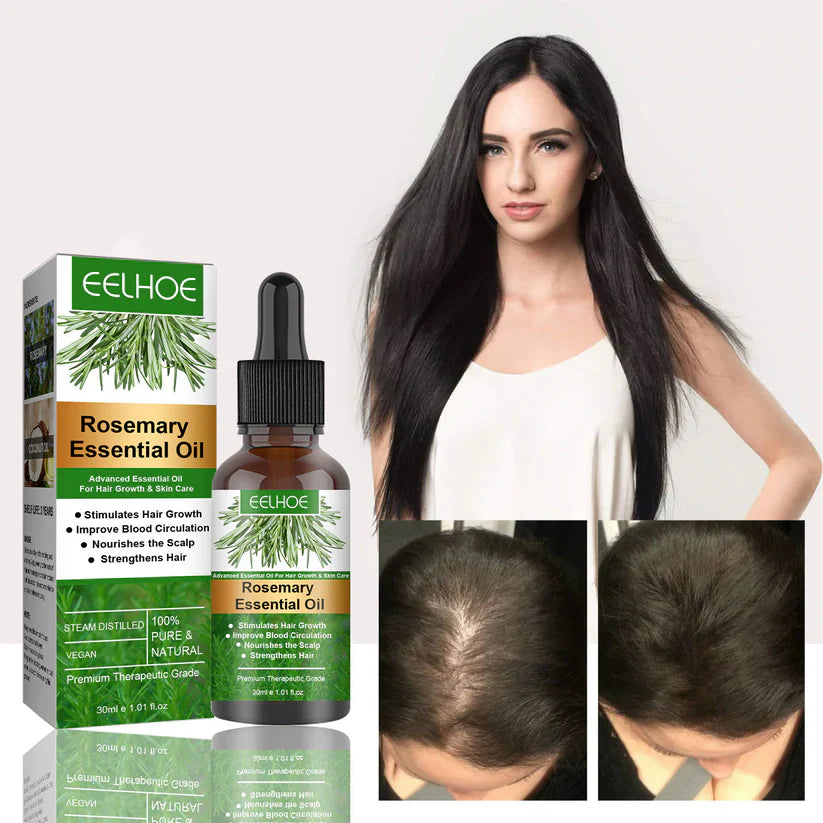 Rosemary Oil Blend -Hair Growth