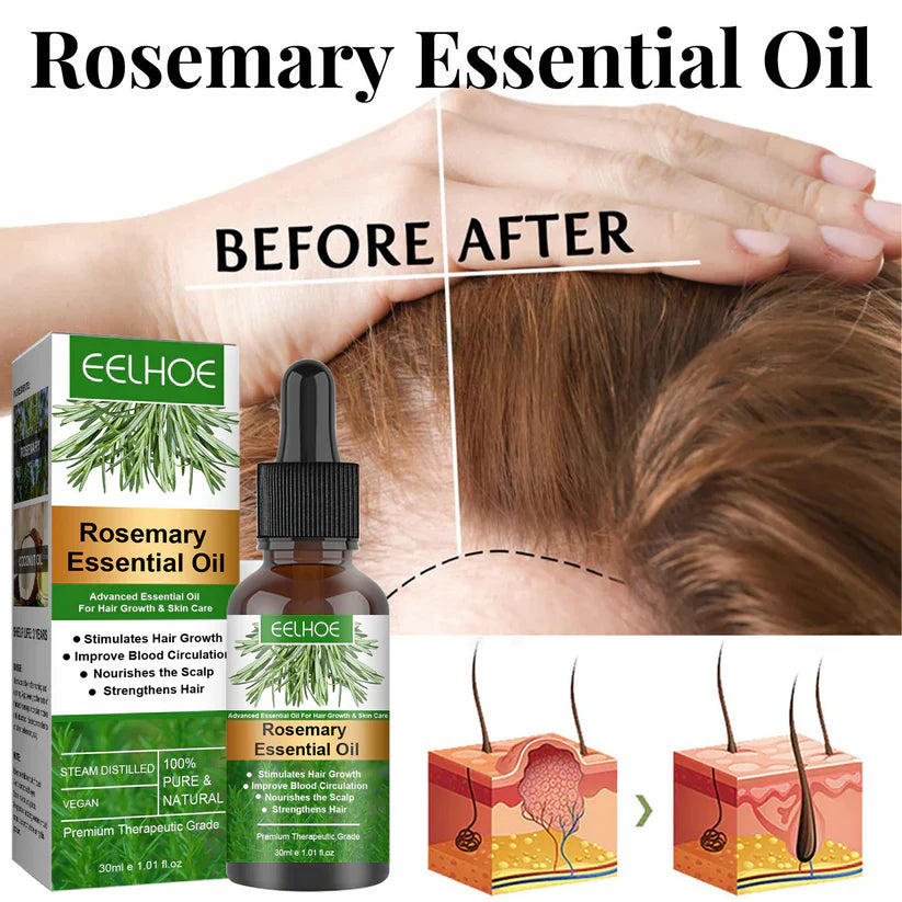 Rosemary Oil Blend -Hair Growth